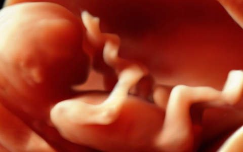 四维彩超有必要做吗？